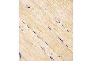 Immunohistochemistry (Paraffin-embedded Sections) (IHC (p)) image for anti-RAB7A, Member RAS Oncogene Family (RAB7A) (AA 176-204), (C-Term) antibody (ABIN652609)