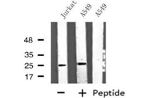 Western blot analysis of extracts from A549/Jurkat cells, using ARHGDIG antibody. (ARHGDIG Antikörper  (Internal Region))