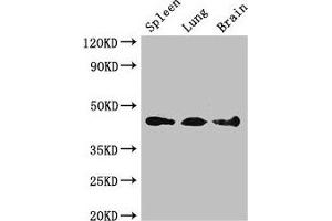 Western Blot Positive WB detected in: Mouse spleen tissue, Mouse lung tissue, Mouse brain tissue All lanes: NCF1 antibody at 3 μg/mL Secondary Goat polyclonal to rabbit IgG at 1/50000 dilution Predicted band size: 45, 31 kDa Observed band size: 45 kDa (NCF1 Antikörper  (AA 63-232))