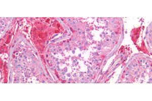 Detection of S100A6 in Human Testis Tissue using Polyclonal Antibody to S100 Calcium Binding Protein A6 (S100A6) (S100A6 Antikörper  (AA 1-90))