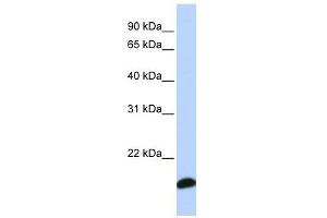 PRDX5 antibody used at 1 ug/ml to detect target protein. (Peroxiredoxin 5 Antikörper  (Middle Region))