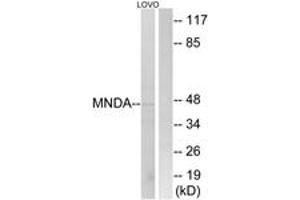Western Blotting (WB) image for anti-Myeloid Cell Nuclear Differentiation Antigen (MNDA) (AA 358-407) antibody (ABIN2890426) (MNDA Antikörper  (AA 358-407))