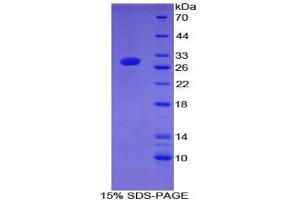 SDS-PAGE analysis of Mouse Coagulation Factor XII Protein. (F12 Protein)