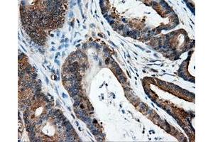Immunohistochemical staining of paraffin-embedded Kidney tissue using anti-IFT57mouse monoclonal antibody. (IFT57 Antikörper)
