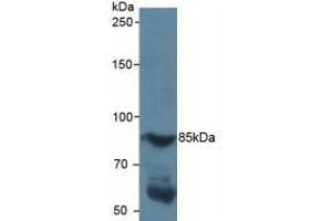 Detection of HIF1a in Human Serum using Polyclonal Antibody to Hypoxia Inducible Factor 1 Alpha (HIF1a) (HIF1A Antikörper  (AA 218-506))