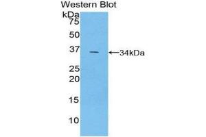 Western Blotting (WB) image for anti-TNF Receptor-Associated Factor 5 (TRAF5) (AA 181-437) antibody (ABIN1860860) (TRAF5 Antikörper  (AA 181-437))