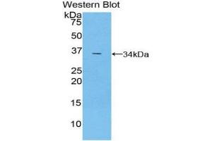 Western Blotting (WB) image for anti-TNF Receptor-Associated Factor 5 (TRAF5) (AA 181-437) antibody (ABIN3203226) (TRAF5 Antikörper  (AA 181-437))