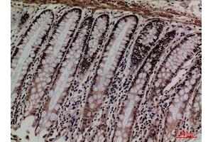 Immunohistochemistry (IHC) image for anti-Minichromosome Maintenance Complex Component 3 (MCM3) (Internal Region) antibody (ABIN6287318)