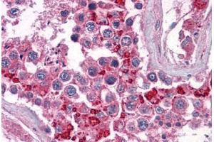 Human Testis: Formalin-Fixed, Paraffin-Embedded (FFPE) (BIRC3 Antikörper  (AA 314-508))