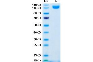 IL31RA Protein (AA 20-519) (Fc Tag)