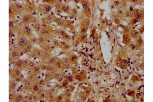IHC image of ABIN7154041 diluted at 1:300 and staining in paraffin-embedded human liver tissue performed on a Leica BondTM system. (PET112L Antikörper  (AA 301-383))
