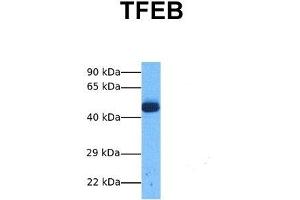 Host:  Rabbit  Target Name:  TFEB  Sample Tissue:  Human Lung Tumor  Antibody Dilution:  1. (TFEB Antikörper  (Middle Region))
