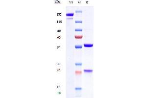 Anti- Human TSLP( Tezepelumab) on SDS-PAGE under reducing (R) condition. (Rekombinanter TSLP (Tezepelumab Biosimilar) Antikörper)