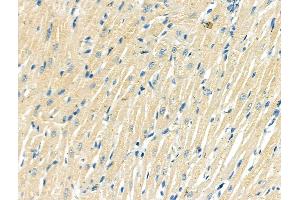 ABIN6262610 and ABIN6268748 at 1/100 staining Rat heart tissue by IHC-P. (ITGA5 Antikörper  (Internal Region))