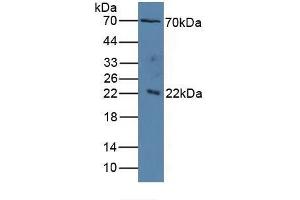 Detection of IL1RAP in Human Serum using Polyclonal Antibody to Interleukin 1 Receptor Accessory Protein (IL1RAP) (IL1RAP Antikörper  (AA 420-558))