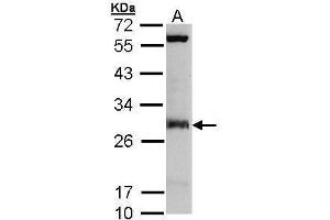 WB Image Sample (30 ug of whole cell lysate) A: Molt-4 , 12% SDS PAGE antibody diluted at 1:3000 (IDI1 Antikörper)