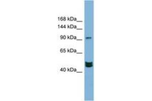Image no. 1 for anti-Mastermind-Like 3 (MAML3) (AA 791-840) antibody (ABIN6742125) (MAML3 Antikörper  (AA 791-840))