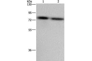 Western Blot analysis of LoVo and Hela cell using PABPC1 Polyclonal Antibody at dilution of 1:500 (PABP Antikörper)