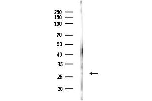 anti-MOB1, Mps One Binder Kinase Activator-Like 1B (MOBKL1B) (Internal Region) antibody