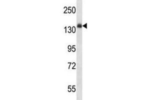 Western Blotting (WB) image for anti-Insulin Receptor (INSR) (AA 546-574) antibody (ABIN3028738)