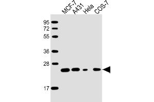 All lanes : Anti-RAB21 Antibody at 1:2000 dilution Lane 1: MCF-7 whole cell lysate Lane 2: A431 whole cell lysate Lane 3: Hela whole cell lysate Lane 4: COS-7 whole cell lysate Lysates/proteins at 20 μg per lane. (RAB21 Antikörper  (AA 1-225))