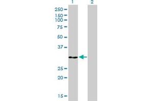 Western Blot analysis of ANXA5 expression in transfected 293T cell line by ANXA5 monoclonal antibody (M01), clone 1F4-1A5. (Annexin V Antikörper  (AA 1-320))