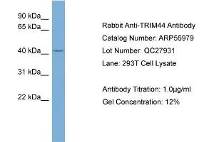 WB Suggested Anti-TRIM44  Antibody Titration: 0.