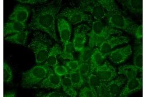 Immunocytochemistry (ICC) image for anti-Heat Shock Protein 90kDa alpha (Cytosolic), Class A Member 2 (HSP90AA2) antibody (ABIN361664)
