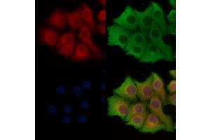 ABIN6261687 and ABIN6277900 staining Hela cells by IF/ICC. (SLC27A1 Antikörper  (Internal Region))