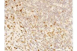 ABIN6267273 at 1/100 staining human appendiceal tissue sections by IHC-P.