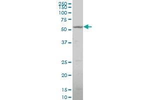 Western Blotting (WB) image for anti-Cytochrome P450, Family 26, Subfamily B, Polypeptide 1 (CYP26B1) (AA 131-230) antibody (ABIN566028)