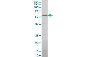 CYP26B1 polyclonal antibody (A01), Lot # ORU0060223QCS1 Western Blot analysis of CYP26B1 expression in K-562 . (CYP26B1 Antikörper  (AA 131-230))