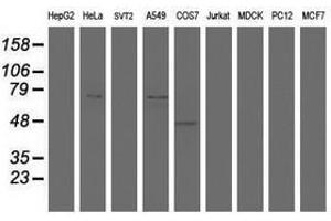 Image no. 1 for anti-HBS1-Like (HBS1L) (AA 1-260) antibody (ABIN1490655) (HBS1L Antikörper  (AA 1-260))