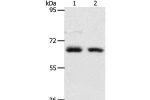 Western Blot analysis of Human fetal kidney and fetal lung tissue using ACOT11 Polyclonal Antibody at dilution of 1:450 (ACOT11 Antikörper)