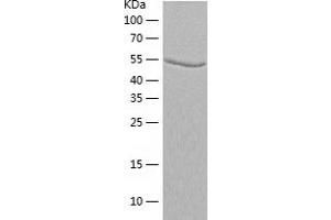 Western Blotting (WB) image for Adenylosuccinate Lyase (ADSL) (AA 1-484) protein (His tag) (ABIN7121722)