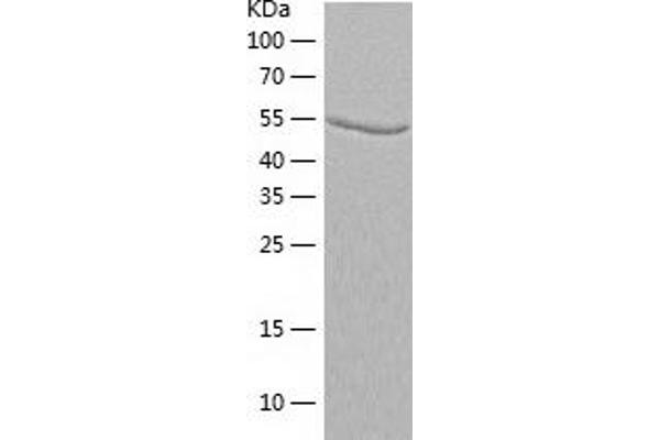 Adenylosuccinate Lyase Protein (ADSL) (AA 1-484) (His tag)
