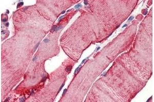 Human Skeletal Muscle (formalin-fixed, paraffin-embedded) stained with Heat Shock Protein 27 (HSP27) antibody ABIN462101 at 10 ug/ml followed by biotinylated goat anti-rabbit IgG secondary antibody ABIN481713, alkaline phosphatase-streptavidin and chromogen. (HSP27 Antikörper)