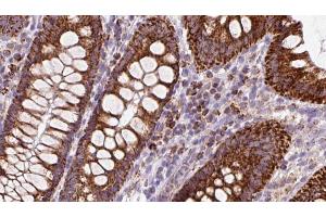 ABIN6272972 at 1/100 staining Mouse colon tissue by IHC-P. (OSBP Antikörper  (Internal Region))