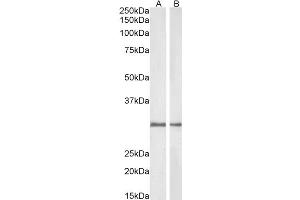 ABIN184714 (1µg/ml) staining of Rat (A) and Pig (B) Kidney lysate (35µg protein in RIPA buffer). (NQO1 Antikörper  (C-Term))