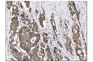 IHC analysis of AS160/TBC1D4 using anti-AS160/TBC1D4 antibody (ABIN7599745). (TBC1D4 Antikörper  (AA 1118-1298))