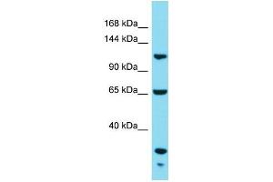 Western Blotting (WB) image for anti-KIAA1522 (KIAA1522) (C-Term) antibody (ABIN2791616) (KIAA1522 Antikörper  (C-Term))