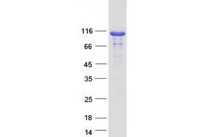 Western Blotting (WB) image for Hepatocyte Growth Factor-Regulated tyrosine Kinase Substrate (HGS) protein (Myc-DYKDDDDK Tag) (ABIN2722699)