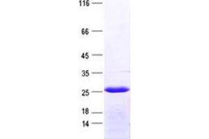 Validation with Western Blot (GS28 Protein (His tag))