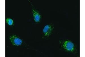 IF analysis of TRK fused gene/TFG using anti-TRK fused gene/TFG antibody (ABIN7599839). (TFG Antikörper  (AA 121-400))