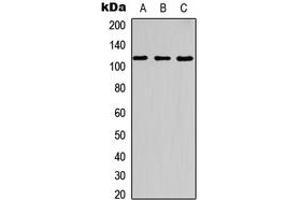 Western blot analysis of c-CBL (pY700) expression in HT29 UV-treated (A), NIH3T3 (B), rat kidney (C) whole cell lysates. (CBL Antikörper  (C-Term, pTyr700))