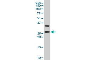 ARHGDIG polyclonal antibody (A01), Lot # 050921JC01 Western Blot analysis of ARHGDIG expression in 293 . (ARHGDIG Antikörper  (AA 1-225))