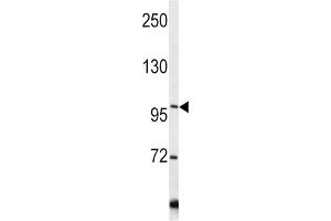 Western Blotting (WB) image for anti-Collagen, Type VI, alpha 1 (COL6A1) antibody (ABIN3002700) (COL6A1 Antikörper)