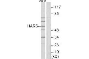 Western blot analysis of extracts from HeLa cells, using HARS antibody. (HARS1/Jo-1 Antikörper  (C-Term))