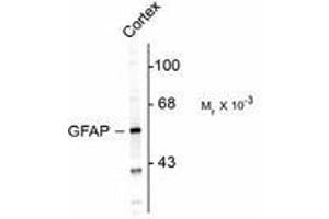 Image no. 1 for anti-Glial Fibrillary Acidic Protein (GFAP) antibody (ABIN303954) (GFAP Antikörper)