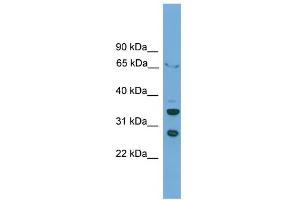 WB Suggested Anti-DBP Antibody Titration: 0. (DBP Antikörper  (C-Term))